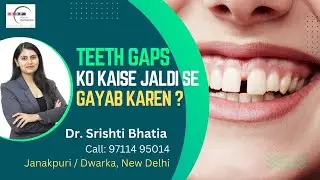 Teeth GAPS ko Kaise Jaldi Gayab Karen? Dr. Srishti Bhatia #smilemakeover #smile