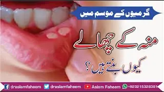 Mouth Ulcer Causes & Treatment | Munh K Chalo Ka Ilaj Urdu/Hindi , منہ کے چھالے کیوں بنتے ہیں