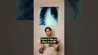 Radiology Rapid Review 🩻 : How Many Can You Diagnose? #shorts #doctor #medicalstudent
