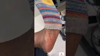 N Ebony Nurse Sock Removal & Big Dry Stinky Sole At Work [SHORTS]