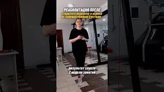 Реабилитация после травмы голеностопного сустава. Открытый перелом,  нога в гипсе 2 месяца.