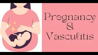 Pregnancy and Vasculitis