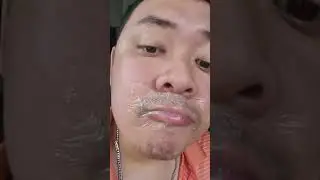 băng keo y tế dán miệng mỏng dẻo