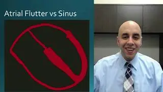 Atrial Flutter for Patients