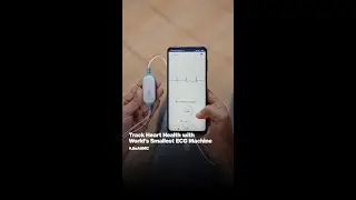 Track Heart Health with World's Smallest ECG Machine #JioAtIMC