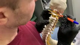 Anatomy of the cervical spine in Kimmerle anomaly