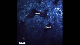 Autofluorescence multiphoton microscopy for visualization of tissue morphology and cellular dynamics