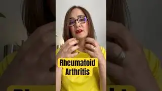 Hand exercises for Rheumatoid Arthritis