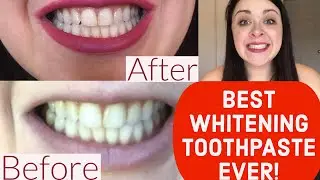BEST WHITENING TOOTHPASTE EVER: REVIEW Crest 3D White Brilliance