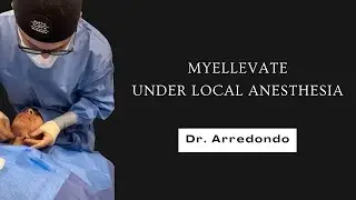 Dr. Arredondo performs MyEllevate to Create a Snatched Jawline