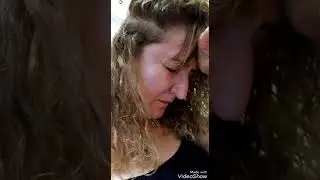 SAÇIMA PRP UYGULAMASI YAPTIRDIM