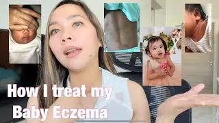 Best Baby Products for Sensitive Skin (Eczema or Atopic Dermatitis) | Philippines