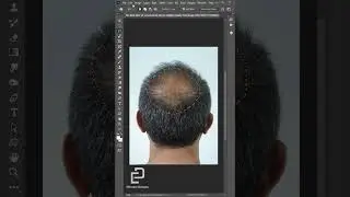 علاج الصلع بالفوتوشوب (Adding Hair By Photoshop)