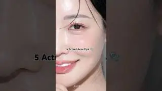 5 Actual Acne Tips 🫧 #aesthetic #acne #acnetreatment #shorts #acneproneskin #tips #acnetips #glowup