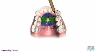 Pendex