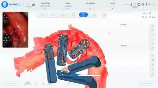 Shining 3d elite photogrammetry workflow