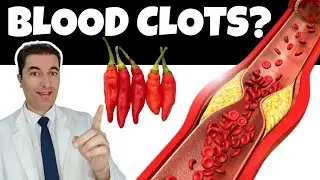 Top 10 Natural Remedies Against BLOOD CLOTS!