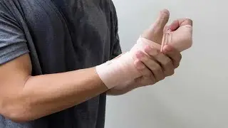 wristbrokesons