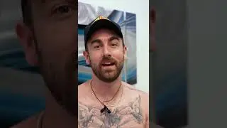 Gynecomastia Testimonial after only 1 week post-op 