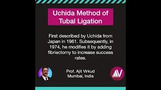 Uchida Technique of Tubal Ligation