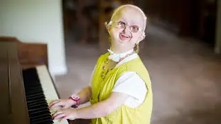 5 ЛЮДЕЙ С НЕОБЫЧНЫМИ БОЛЕЗНЯМИ