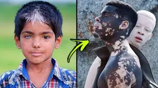 15 Most Unique Humans In The World