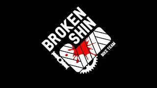 #BrokenShin ปั่นจักรยานขึ้นเขา หลังบ้าน