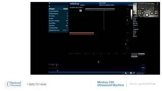 How to use m mode on Mindray Z60