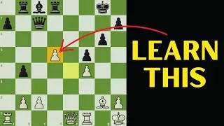 Stop Ignoring Your Pawns: Win More Chess Games