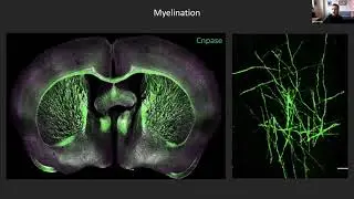 v-NERIC 2021. From Neurocircuitry to Neuromodulation
