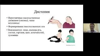 Встреча по болезни Вильсона Коновалова 15 03 23 выступление невролога Нужного Е.П.