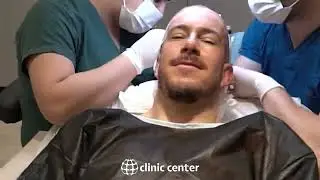 Hair Transplant in Turkey with Clinic Center