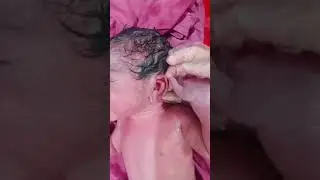 Newborn baby care