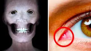 O LADO SOMBRIO DO CORPO HUMANO - 5 COISAS ESTRANHAS QUE SEU CORPO FAZ