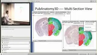 NCIBI Tools and Technology Seminar ---- Pubanatomy 3D