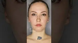 #массаж #massage