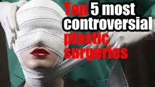 TOP 5 MOST CONTROVERSIAL PLASTIC SURGERIES