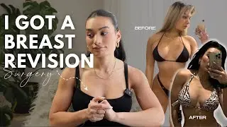 I GOT BREAST REVISION SURGERY  *i didn't think this could happen