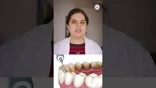 𝐇𝐨𝐰 𝐭𝐨 𝐖𝐡𝐢𝐭𝐞𝐧 𝐘𝐨𝐮𝐫 𝐓𝐞𝐞𝐭𝐡 | Dr. Bhumika Madan | Aakash Healthcare