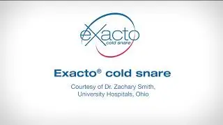 Endoscopic Mucosal Resection of a 3.5cm Tubulovillous Adenoma Polyp with EXACTO™ Cold Snare