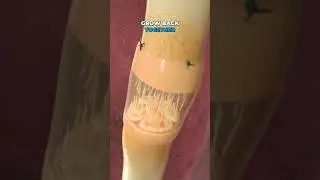 Repairing a severed nerve (3D Animation)
