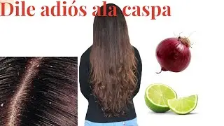 Elimina la caspa en un día How to remove hair dandruff