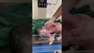 রাখে আল্লাহ মারে কে🤲দেখুন আল্লাহ বাবুটাকে কিভাবে বাঁচিয়ে দিলো