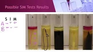 Microbial Physiology: Catalase, Oxidase, SIM, Nitrate