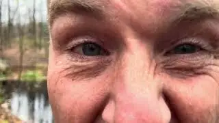 Eye Videos During Vertigo Attacks: Ridiculous or Revolutionary?