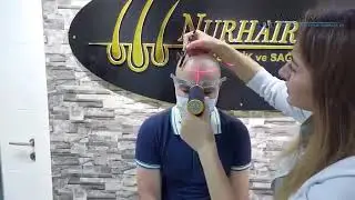 Турецкий центр пересадки волос в Махачкале. REMED NUR HAİR.