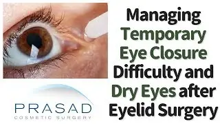 Possible Causes of Dryness and Incomplete Eye Closure after Eyelid Surgery