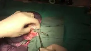 Pedicle Ties for Cat Spay