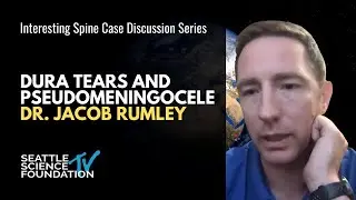 Dura Tears and Pseudomeningocelen - Jacob Rumley, MD