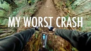 my first injury of the mountain bike season